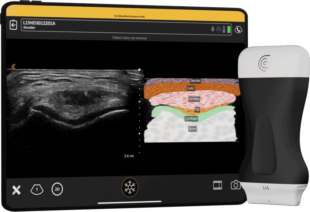Clarius Diagnostic Ultrasound